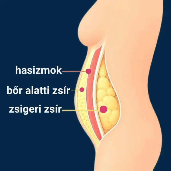 A hasi hízás anatómiája 40 felett: a hasizmok, a bőr alatti zsír és a szerveket körülvevő mély zsigeri zsír elhelyezkedése nőknél